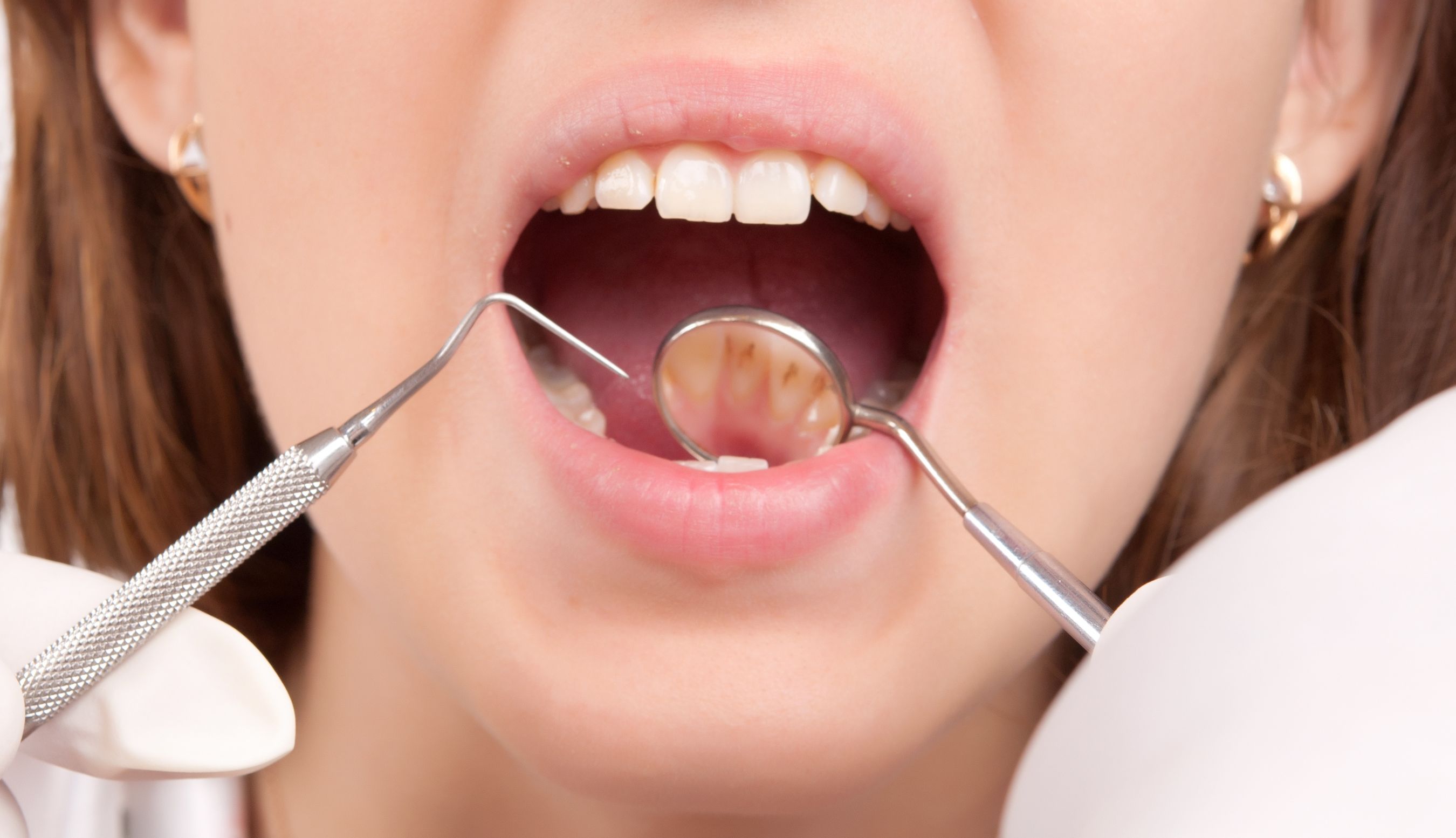 Helpful Services for Dental Practice Sales in California