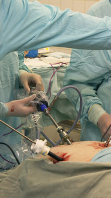 Use Body Sculpting Treatments to Address Unwanted Fat on Your Body