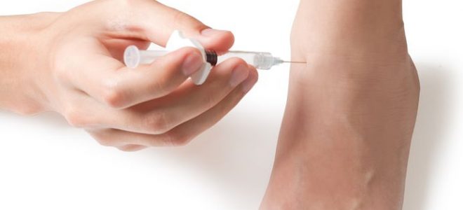 DIFFERENT TYPES OF ORTHOTICS FOR THE KNEE IN Jacksonville FL