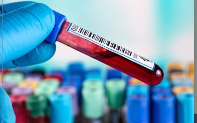 Appreciating the Main Benefits of Undergoing PRP Near Surprise, AZ