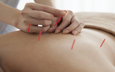 Improve Mental Health Naturally Through Acupuncture For Stress, Berkeley, CA