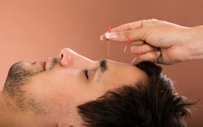 Boost Wellness and Reduce Stress through Acupuncture Therapy in Bellingham, WA Professionals Provide