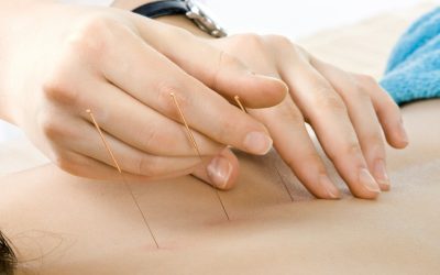 Relieve Chronic Back Issues with Acupuncture For Pain In Newark, CA, and Restore Daily Comfort Fast