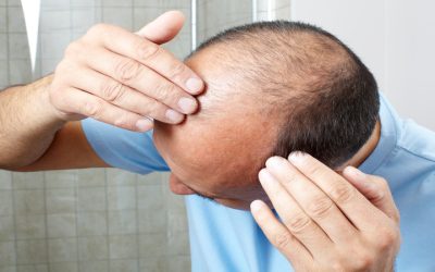 Understanding Options and Benefits for Hair Restoration Specialist In Amherst, NY