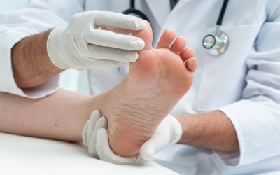 Solutions for Foot Pain Begin with Bunion Treatment Fulshear, TX Residents Prefer